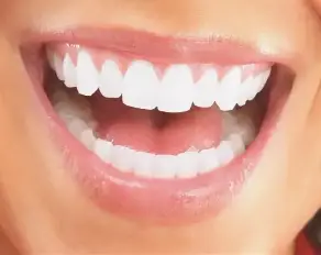 دلیل رنگ گرفتن دندان ها