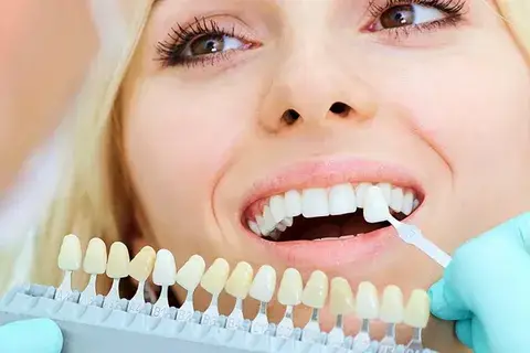 تصویر قراردادن پروتز ثابت دندانی