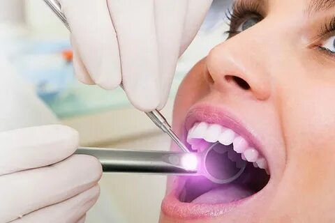 کاربردهای لیزر در دندانپزشکی چیست؟